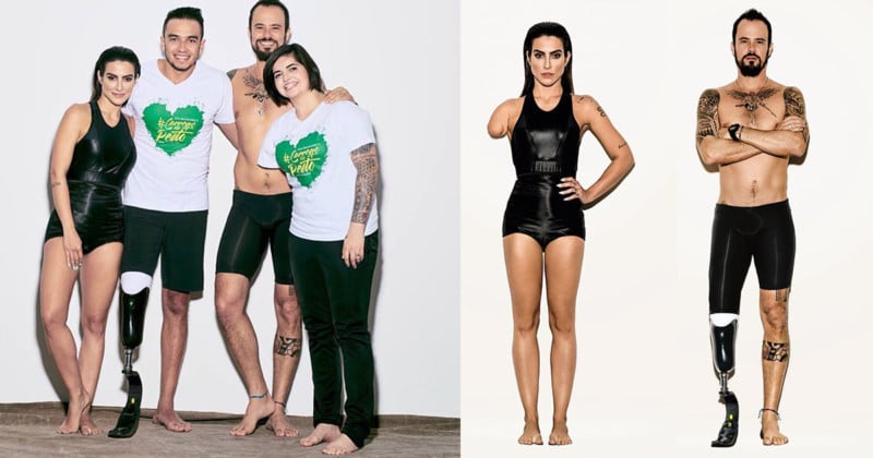 Vogue Photoshopped Away Limbs on Models for Paralympic Photos