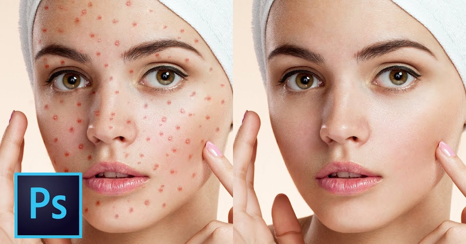 Photoshop Tutorial: The 5 Best Ways to Clean and Heal Skin Blemishes