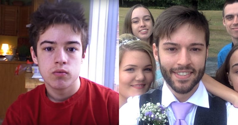This Guy Shot a Selfie a Day from Age 12 to His Wedding Day