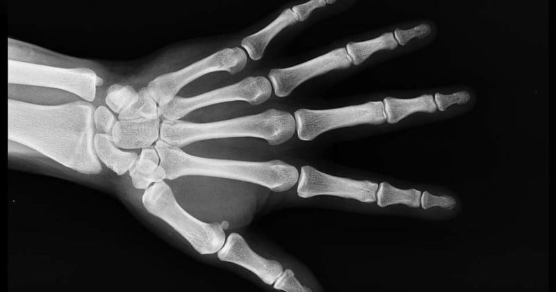 Who Owns the Copyright to Your X-ray?