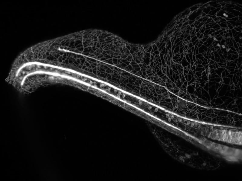 Time-Lapse of Neurons Growing Wins 2018 Nikon Small World in Motion