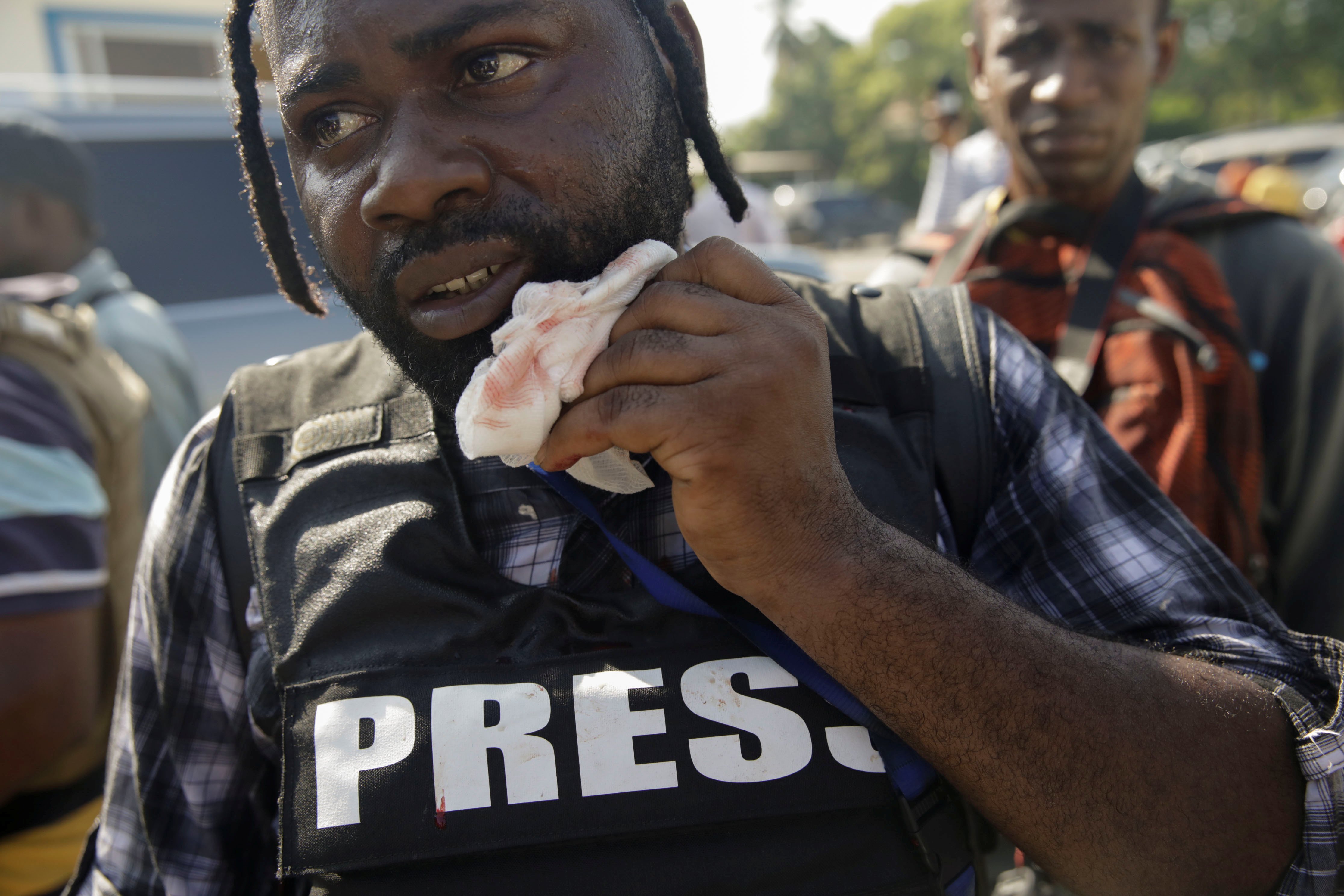  photographer wounded haiti when senator fired gun disperse 