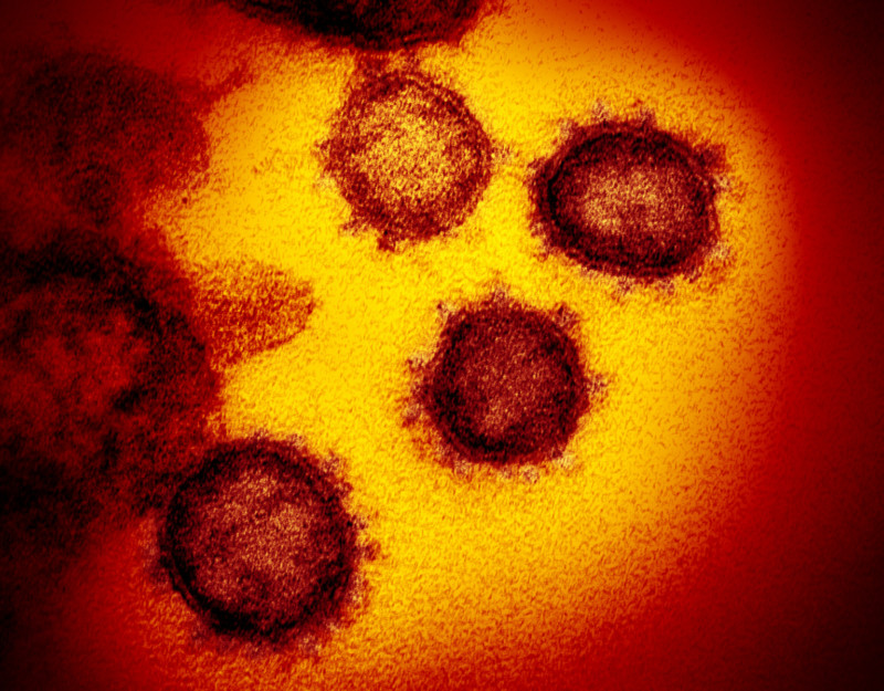How Images of Coronavirus Are Made