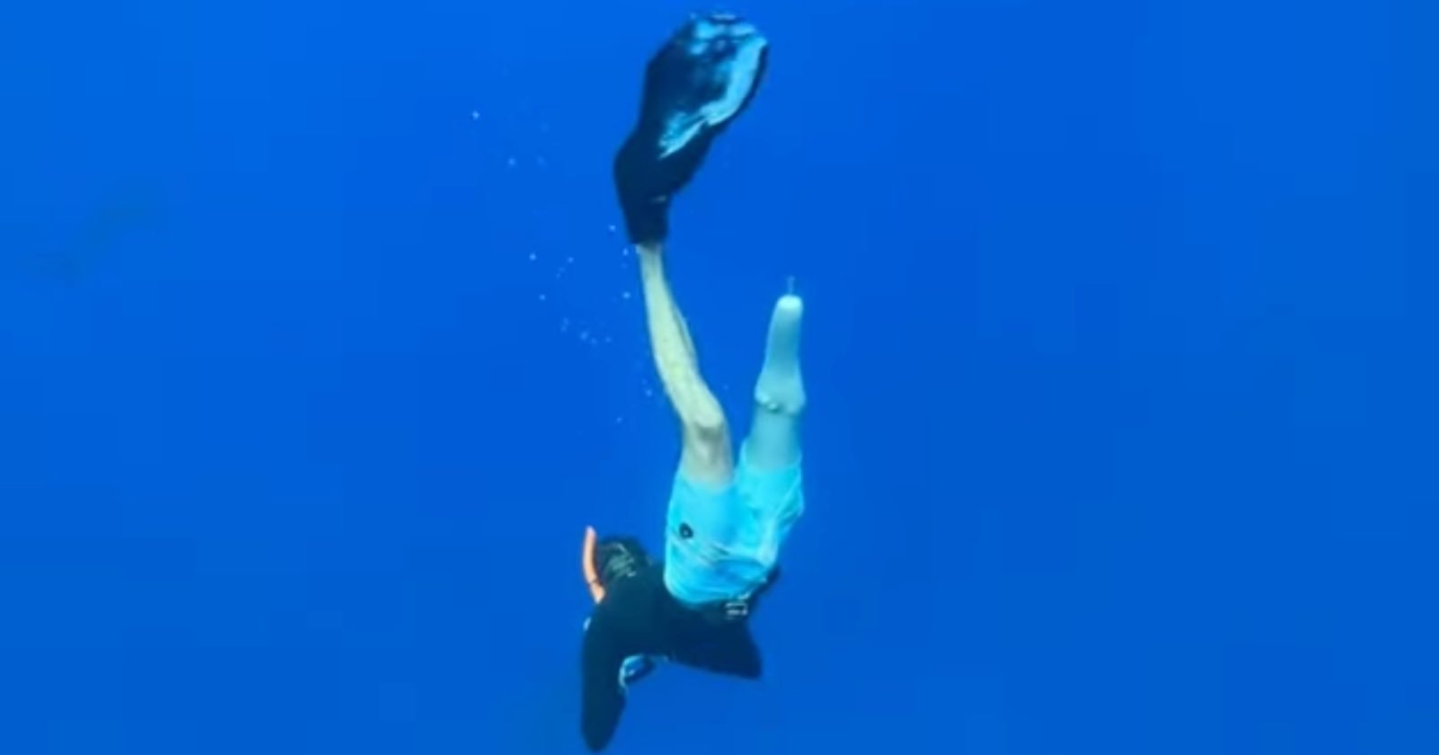 Photographer Recalls The Day A Shark Bit His Leg Off