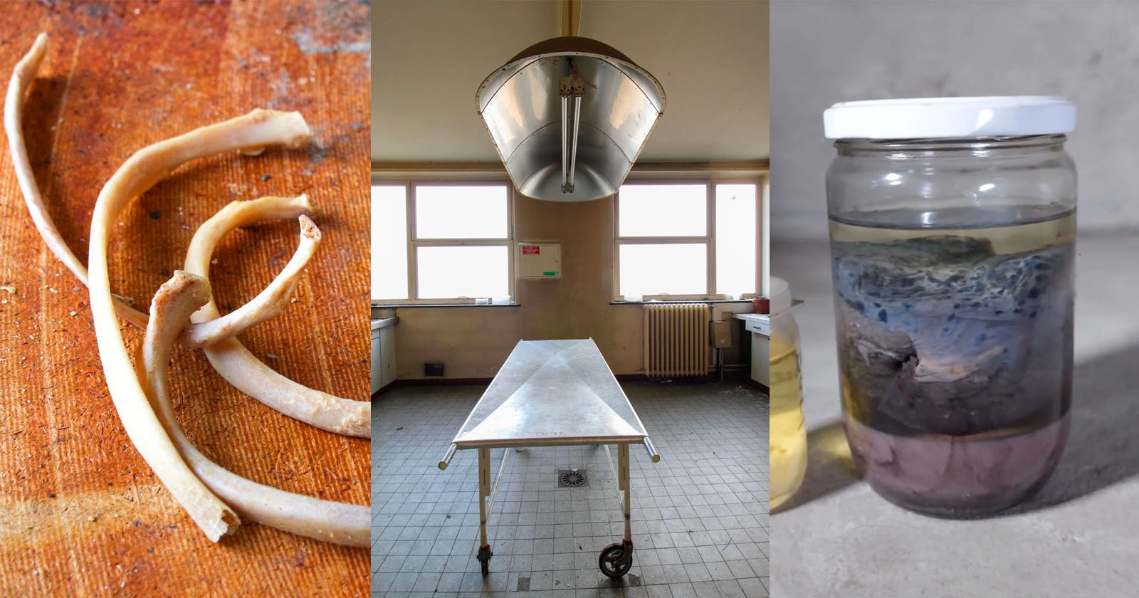 Photographer Finds Humans Bones and Organs Inside Abandoned Morgue