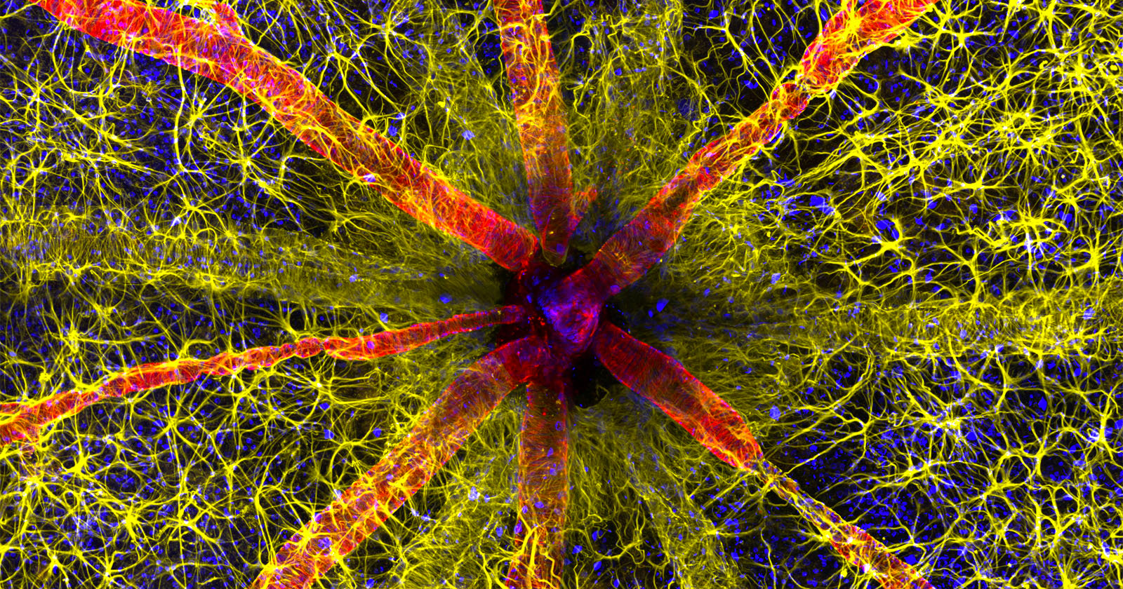 Photo of a Rodents Optic Nerve Wins Nikons 2023 Small World Competition