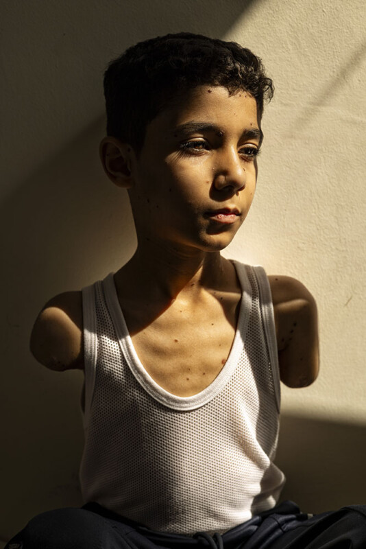 A boy with short curly hair and no arms sits against a beige wall, wearing a white tank top, looking thoughtfully into the distance as sunlight partially illuminates his face and chest.