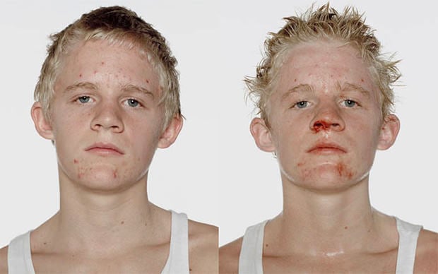 boxers before and after fight