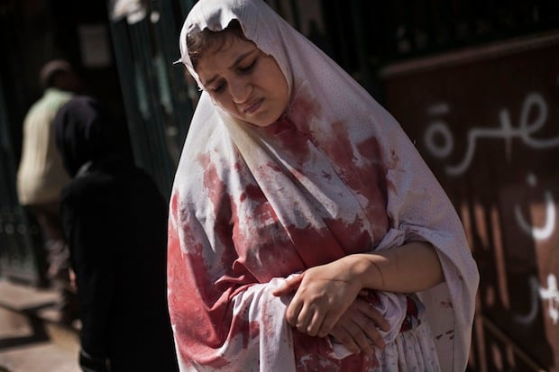A wounded woman leaves a hospital in Aleppo still in shock. (c) Manu Brabo, AP