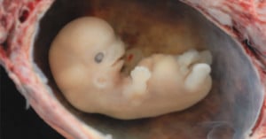 Embryo at 6 weeks