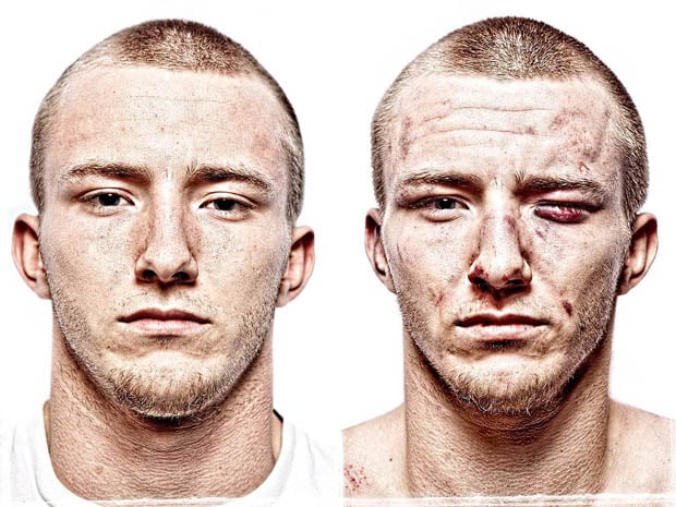 UFC fighter, before and after