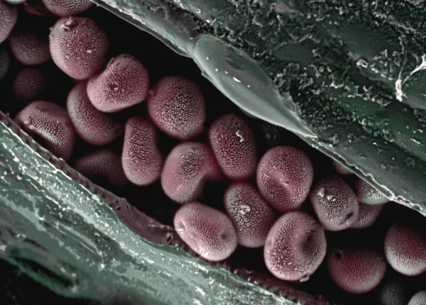 Fungal spores photographed with a scanning electron microscope.