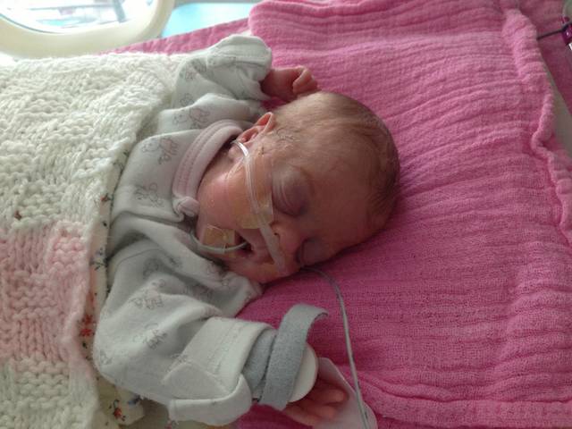 Day 45: After two days on BiPAP, Edie has progressed to Vapotherm, which is also known as High Flow Therapy. She is given humidified oxygen through the nasal cannula, but because she is calm and breathing well she is only breathing 25% O2.