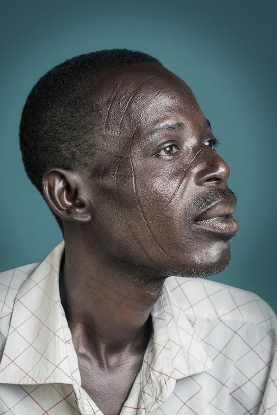 Mr. Pousnouaga: “It was like an identity card in my family. Each tribe has their scars.”