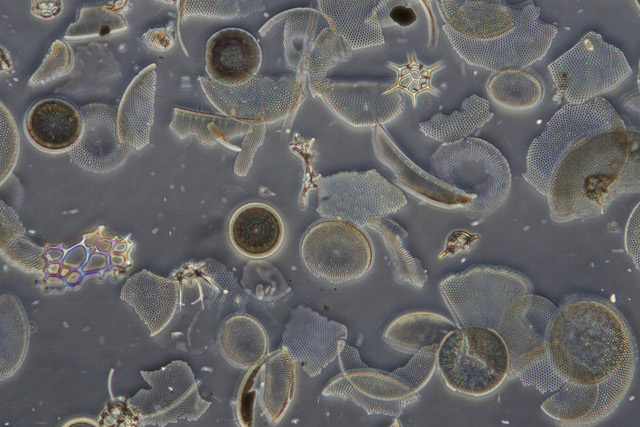 Detritus: Various diatoms, preserved slide from 1919.  