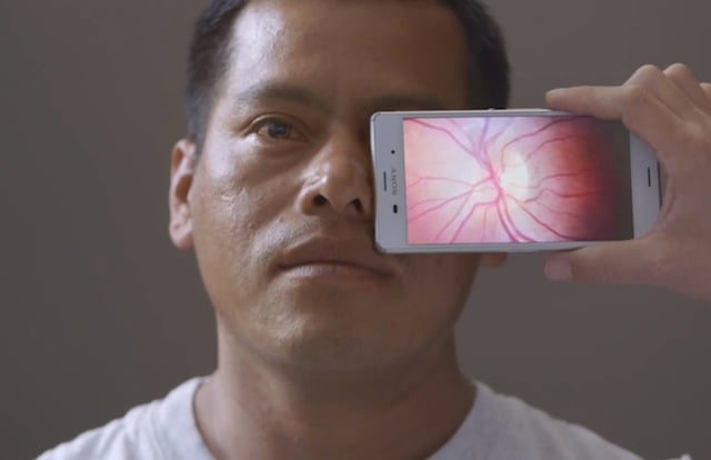 Camera App And Attachment Turns Any Smartphone Into An Eye Exam