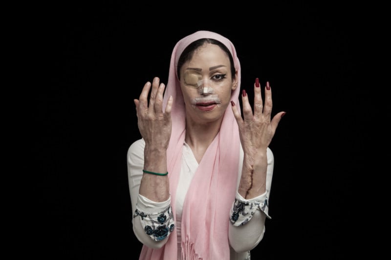 © Asghar Khamseh, Iran, Winner, Professional, Contemporary Issues, 2016 Sony World Photography Awards
