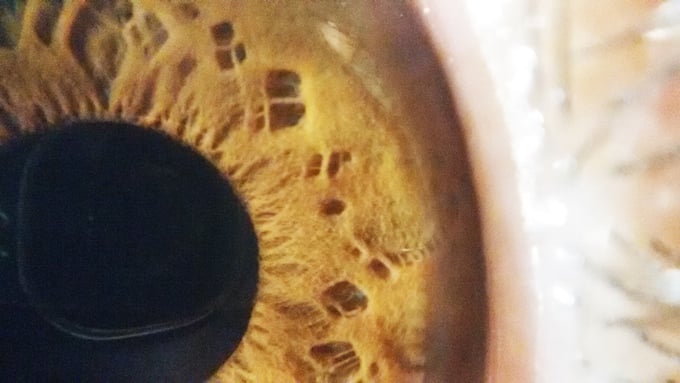 Human eye captured with BLIPS Macro.