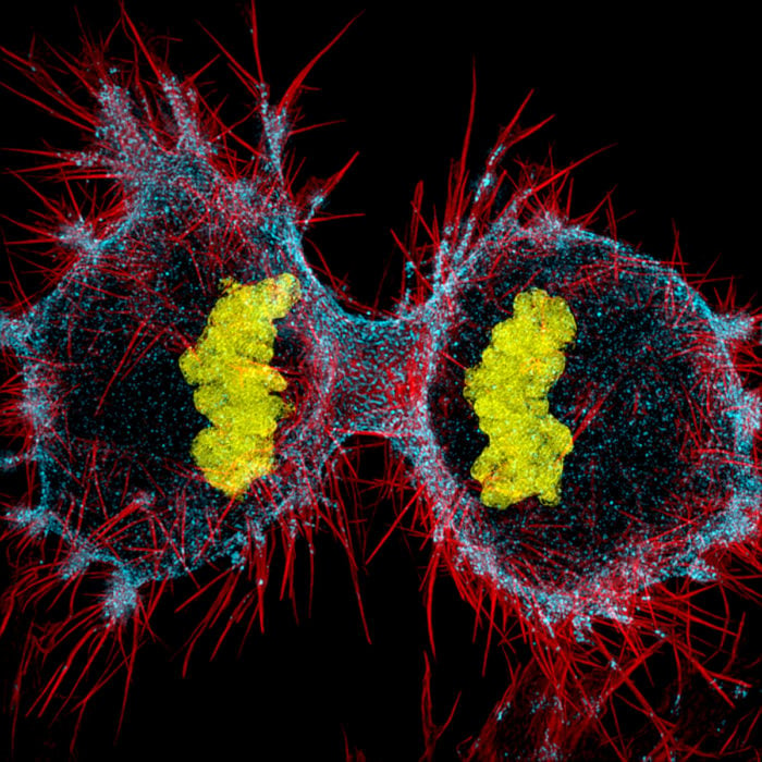 Human HeLa cell undergoing cell division | Photo credit: Dr. Dylan Burnette