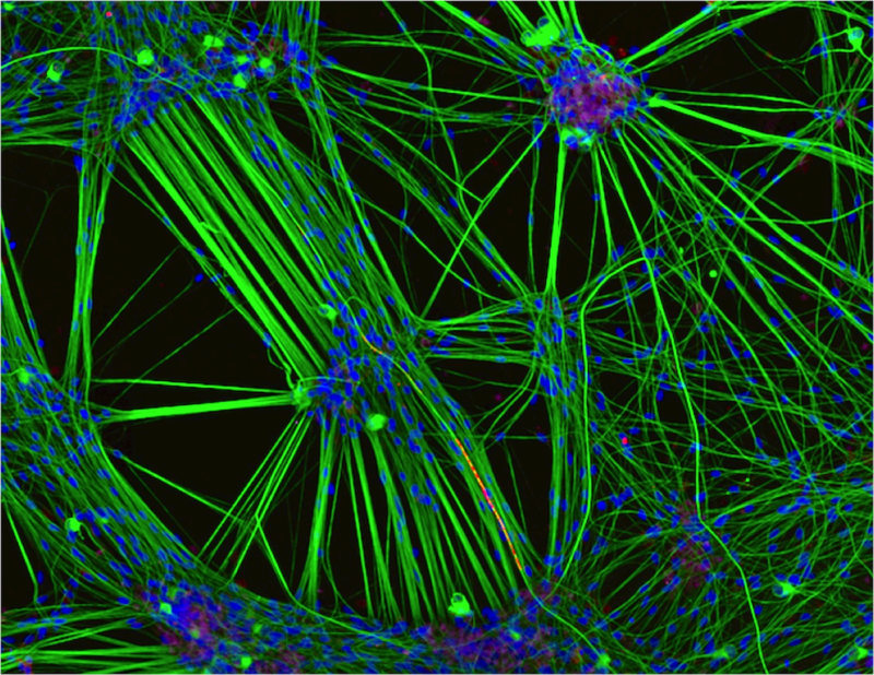 Culture of neurons (stained green) derived from human skin cells, and Schwann cells, a second type of brain cell (stained red) | Photo credit: Rebecca Nutbrown