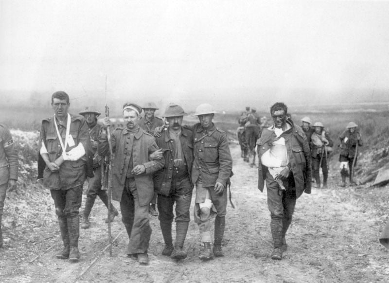 british_wounded_bernafay_wood_19_july_1916