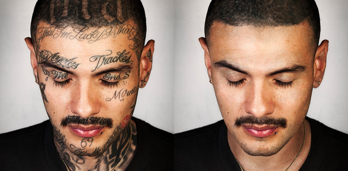 The NYC doctor changing lives by removing gang tattoos for free  Huck