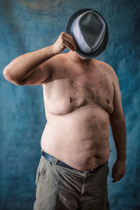 The Boys Who Grew Breasts Portraits of the Effects of Risperdal