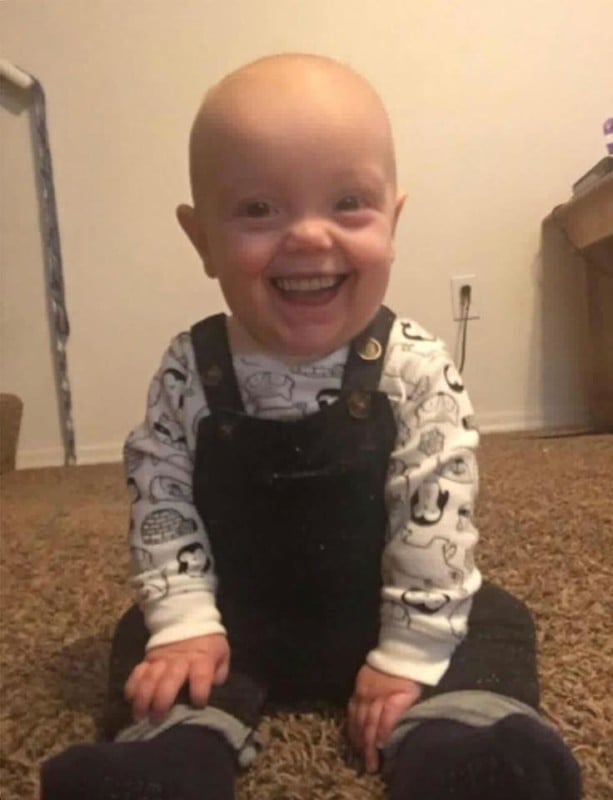 Just 16 Adorable Babies With Creepy Teeth