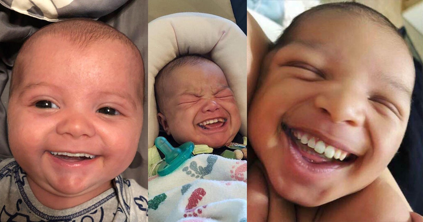 Photos of Babies with Grown-Up Teeth