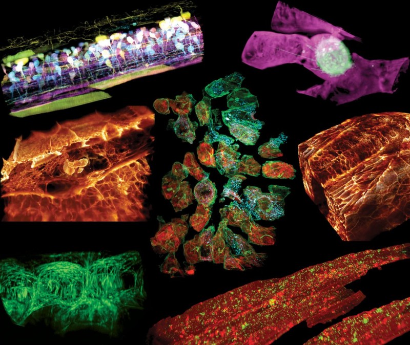 Scientists Capture Time-Lapse of an Immune Cell Moving Through the Body ...