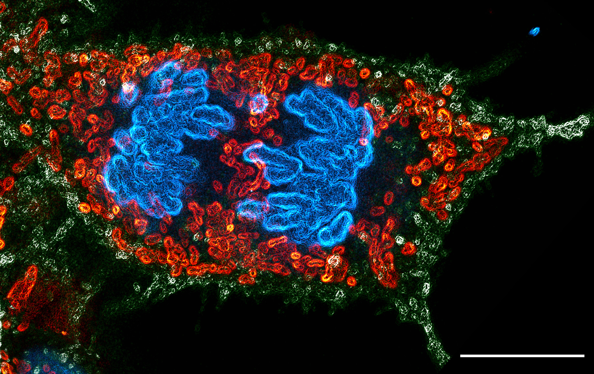 Olympus Unveils the Winners of the Best Life Science Photos of 2020 ...