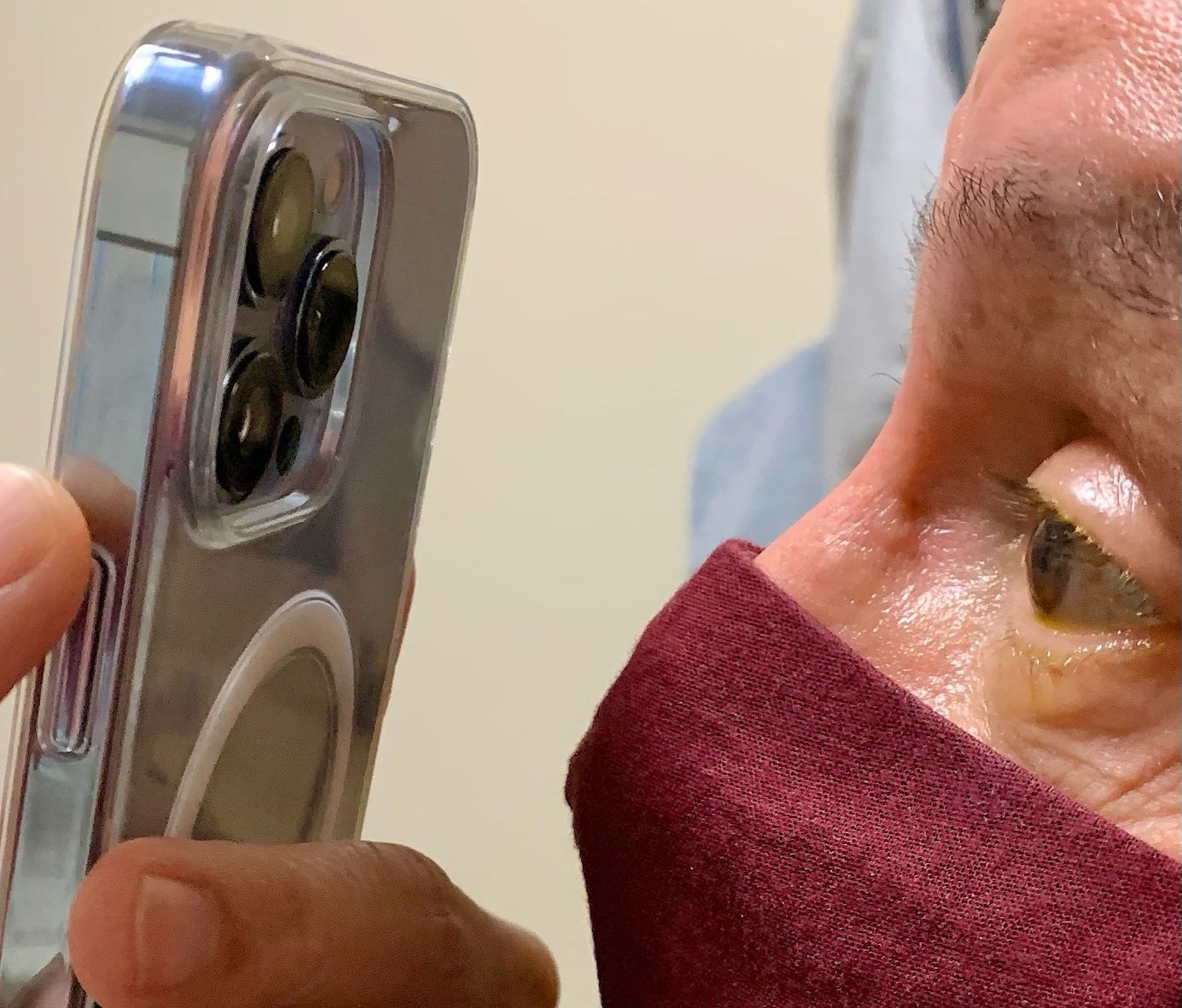 Why This Doctor Uses the iPhone 13 Pro to Photograph Patients' Eyes ...