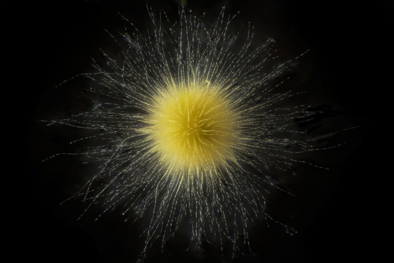 Gloeotrichia - Cyanobacteria, a yellow, spiked planton
