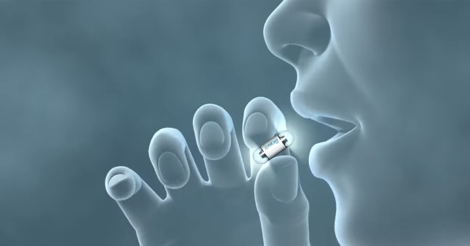 This Swallowable Camera Can Take the Place of Traditional Colonoscopies ...