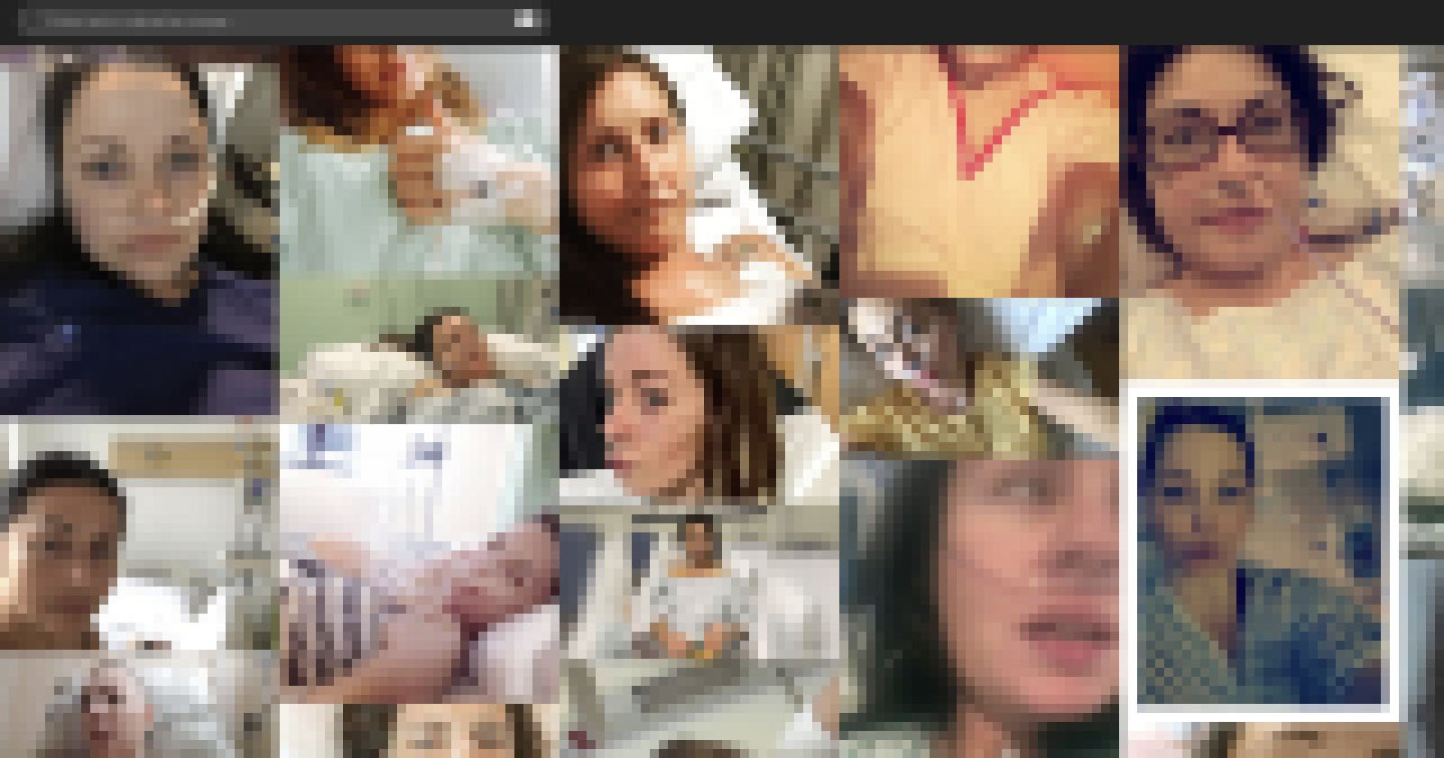 Shocked Artist Finds Private Medical Photos in AI Training Data Set