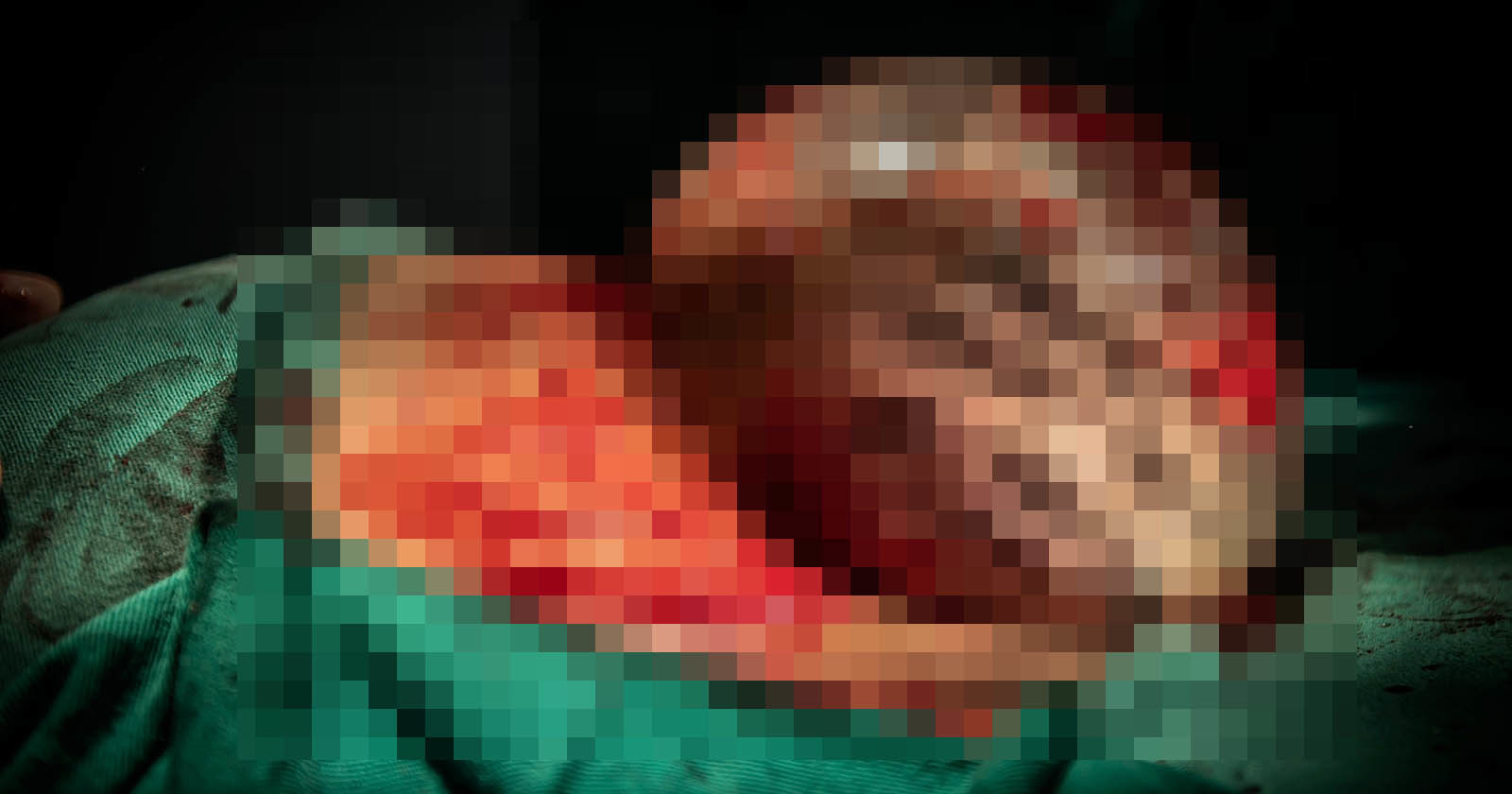Photographer Captures Rare Birth Photo of Baby Still in Amniotic Sac