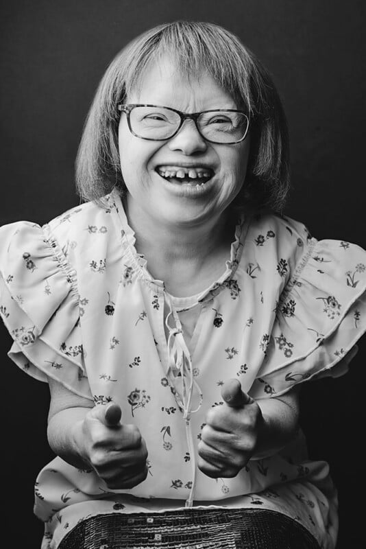 Person with Down syndrome.