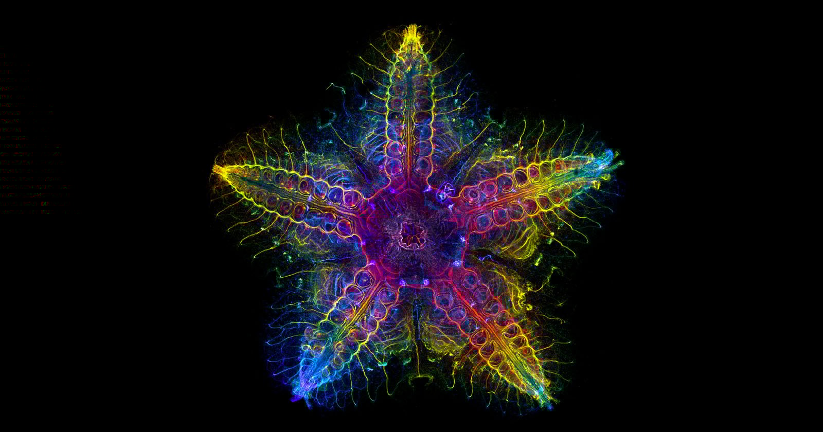 Starfish nervous system