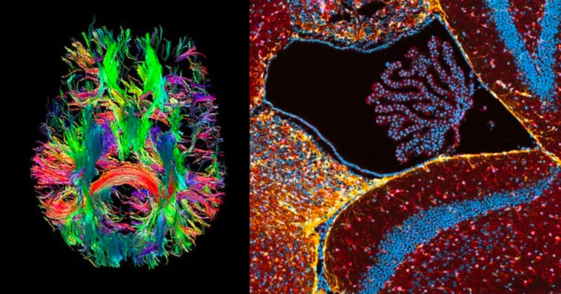 Neuroscience images