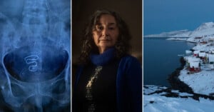 A triptych image featuring an x-ray of human intestines, a portrait of an elderly woman in a blue scarf, and a snowy landscape with small red houses by a frozen shoreline.