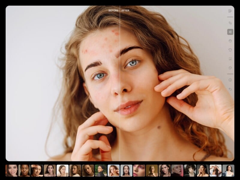 A woman with curly hair is seen in a split-screen image showing before and after effects. The left side of her face shows acne and blemishes, while the right side appears smooth and clear. She is gently touching her face with both hands.