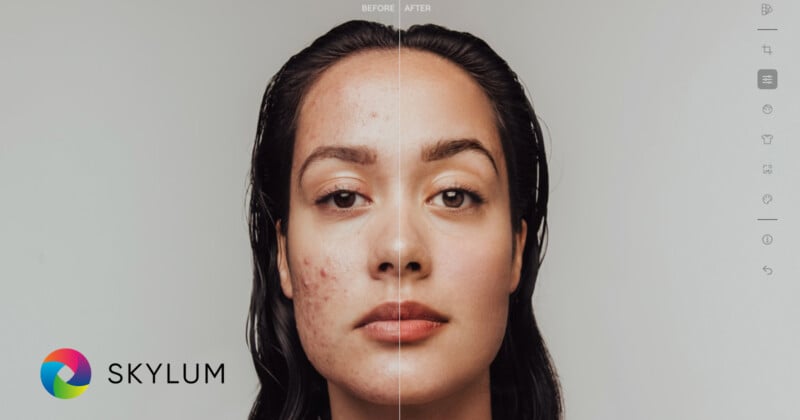 A split image showing a woman's face before and after skin editing. The left side displays blemishes and acne, while the right side is smooth and clear. The word "Skylum" is in the bottom left corner, accompanied by a colorful circular logo.