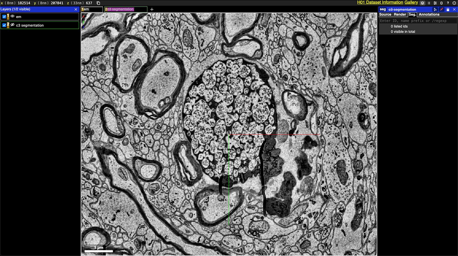Electron micrograph displaying intricate details of cellular structures, with a focus on a specific cell indicated by red markers. A scale bar is present for size reference.