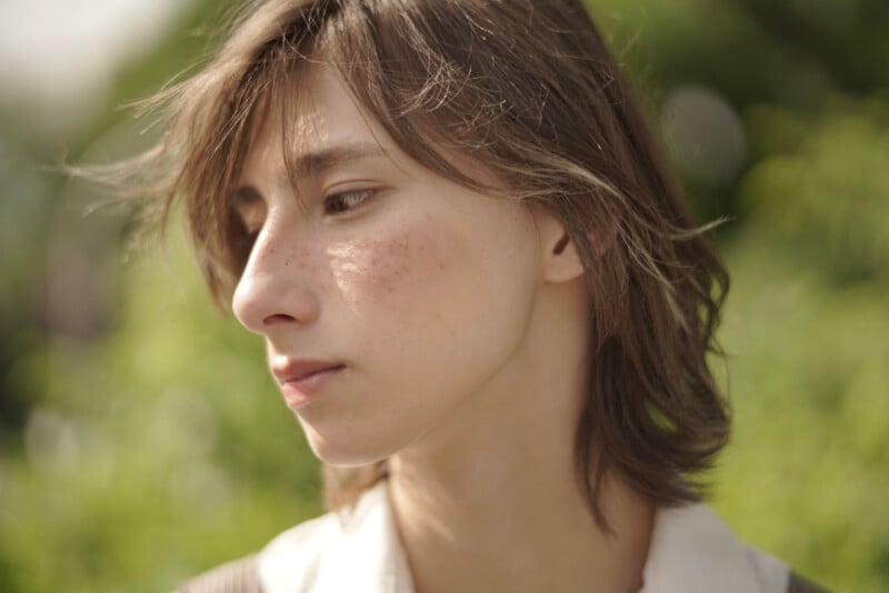 A close-up of a young person with shoulder-length brown hair and a thoughtful expression. They have freckles and some blemishes on their cheeks. The background is a blurred outdoor setting with greenery.