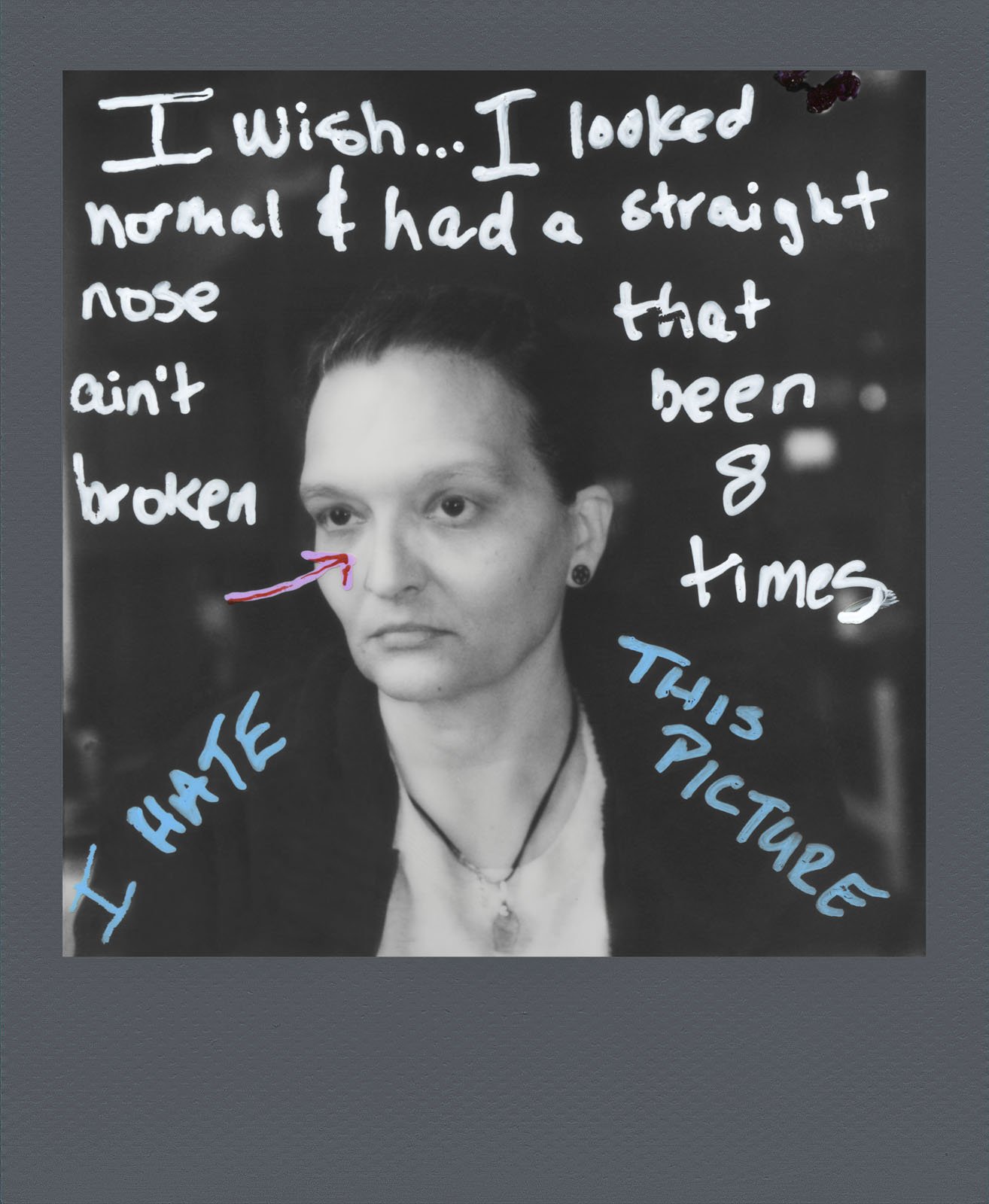 A black-and-white portrait of a person with text overlaying the image. The text reads: "I wish... I looked normal & had a straight nose that ain't been broken 8 times. I hate this picture." An arrow points to the person's nose.