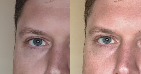 Close-up side-by-side comparison showing the left half of a person's face before (on the left) and after (on the right) a skincare treatment or lighting change. Differences in skin texture and tone are noticeable between the two images.