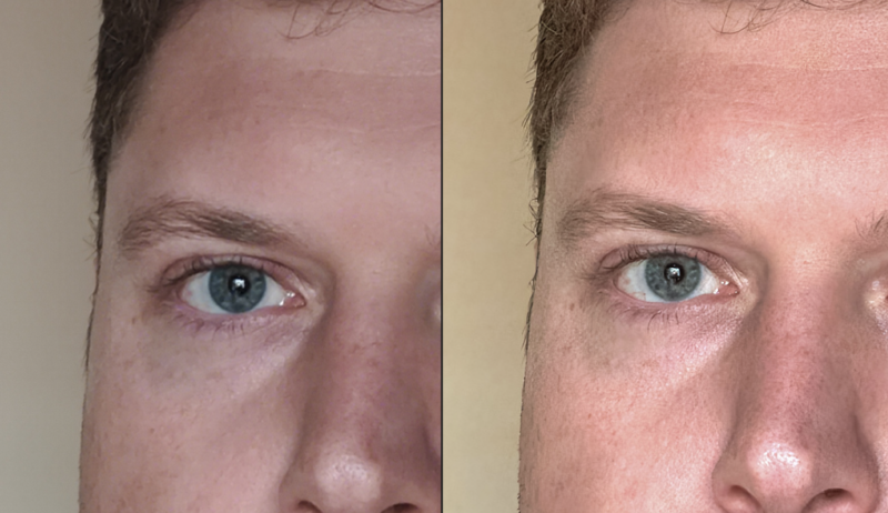 Close-up side-by-side comparison showing the left half of a person's face before (on the left) and after (on the right) a skincare treatment or lighting change. Differences in skin texture and tone are noticeable between the two images.