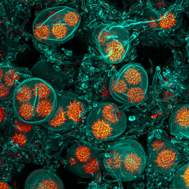 Microscopic view of pollen grains with vibrant orange star-like structures surrounded by a blue-green mesh. The image showcases intricate details of the pollen's surface texture and organization.