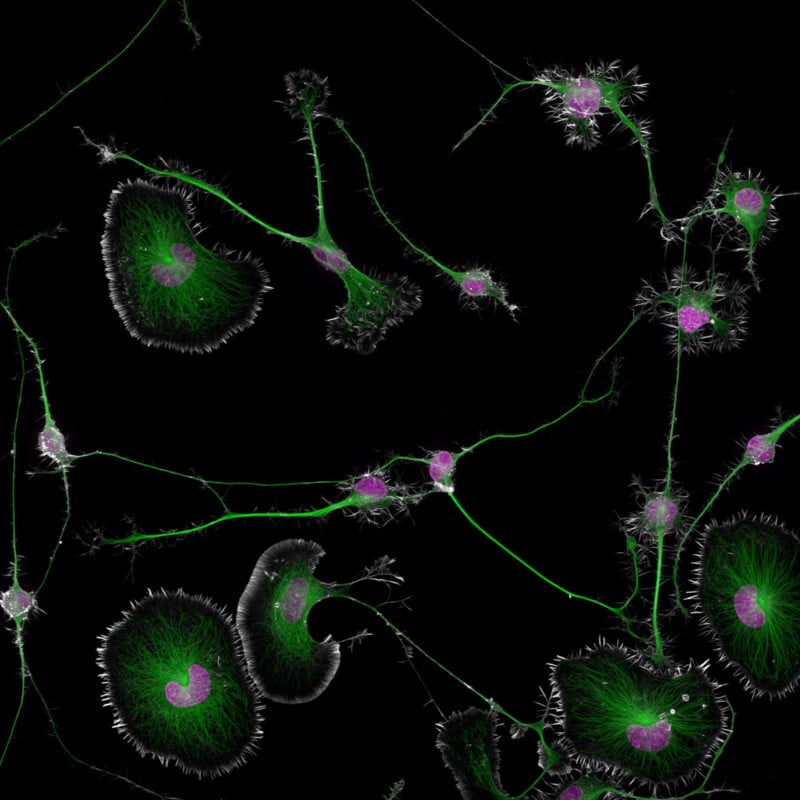 Microscopic image showing bright green and purple neuron cells on a black background. The green indicates the cell structure and long extensions, while purple highlights the nuclei. Cells appear interconnected and detailed, resembling starbursts.