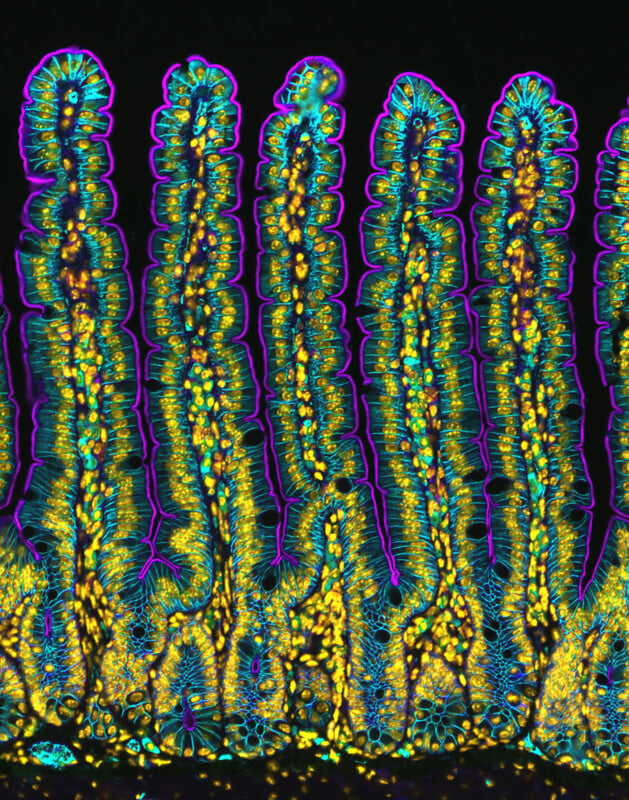 A vibrant microscopic image of mouse colon tissue shows tall, multicolored structures. These structures appear in shades of blue, yellow, and green, outlined in purple, resembling abstract columns against a dark background.